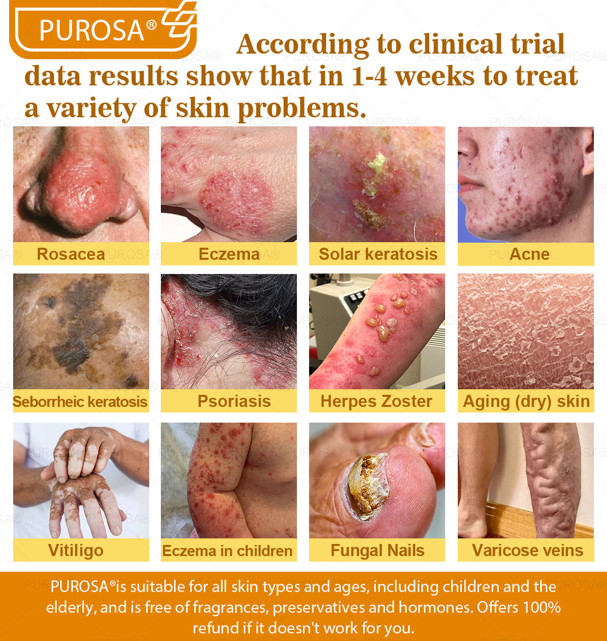 Limited to 10 jars! 🌟PUROSA®—Exclusive 30% discount, restore your skin's youthful glow in just 1-3 weeks! A rare opportunity — won’t be available again until next year, don’t miss out!180-day money-back guarantee, full refund with no risk!