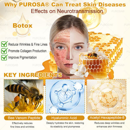 Limited to 10 jars! 🌟PUROSA®—Exclusive 30% discount, restore your skin's youthful glow in just 1-3 weeks! A rare opportunity — won’t be available again until next year, don’t miss out!180-day money-back guarantee, full refund with no risk!